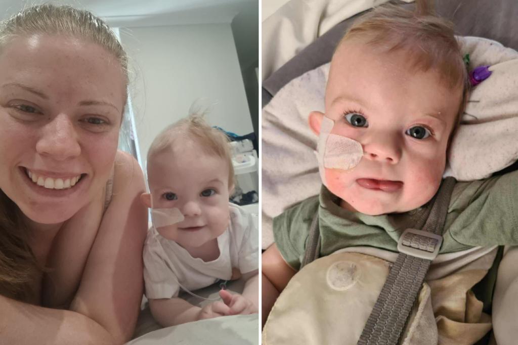 Baby born with rare genetic disorder undergoing eight surgeries in 18 months