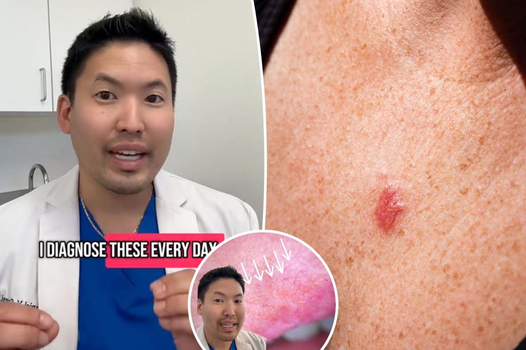 Dermatologist reveals delicate signs that may indicate skin cancer