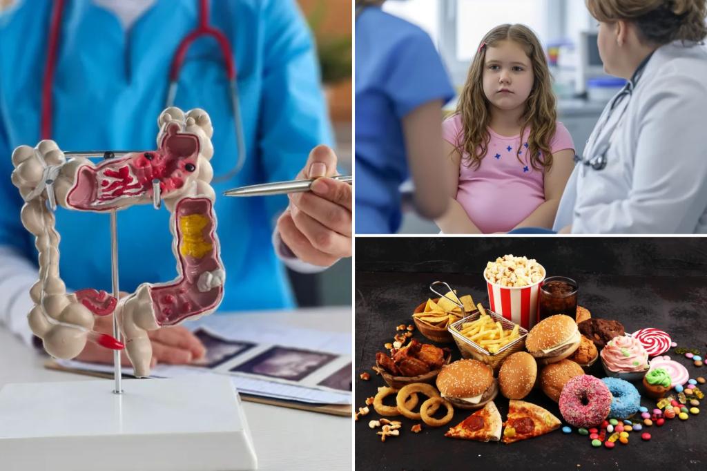 The study links childhood factor to the risk of colorectal cancer