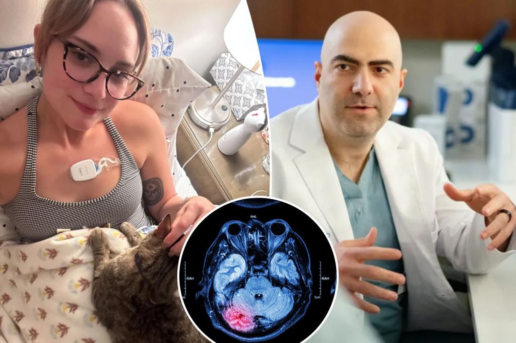 Doctor for what is causing strokes of stroke cases in young people